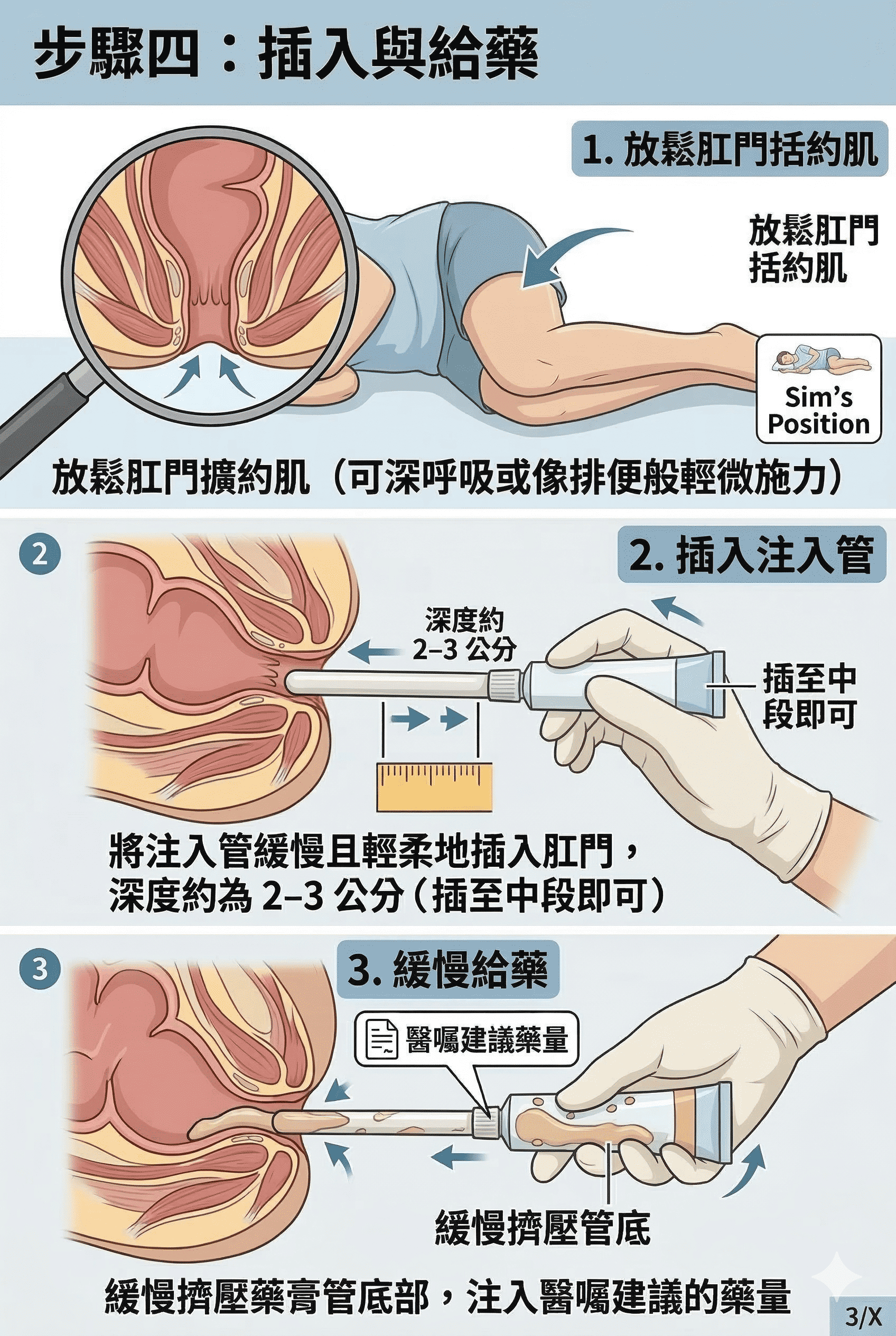痔瘡軟膏(內)第 4 張圖卡